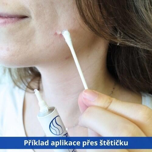 ActiMaris Gel 20 g pro rychlé hojení