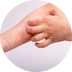 Dermatitida