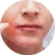 Problematická pleť