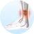 Bércové vředy