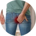 Hemoroidy