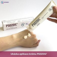 PSOZOIL - Krém na lupénku 100 ml