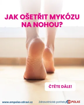 Jak ošetřit mykózu na nohou? Poradíme vám!