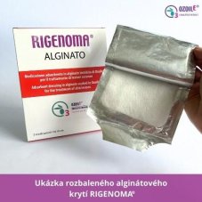 RIGENOMA alginátové krytí s OZOILE 5 ks