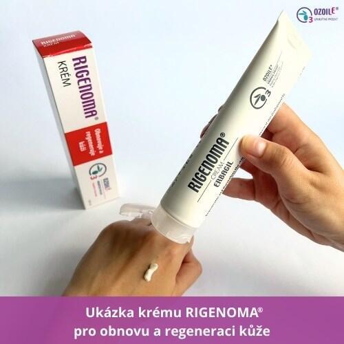 RIGENOMA krém pro obnovu a regeneraci kůže s OZOILE