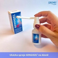 GENGIGEL Sprej na dásně 20 ml