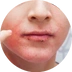 Problematická pleť
