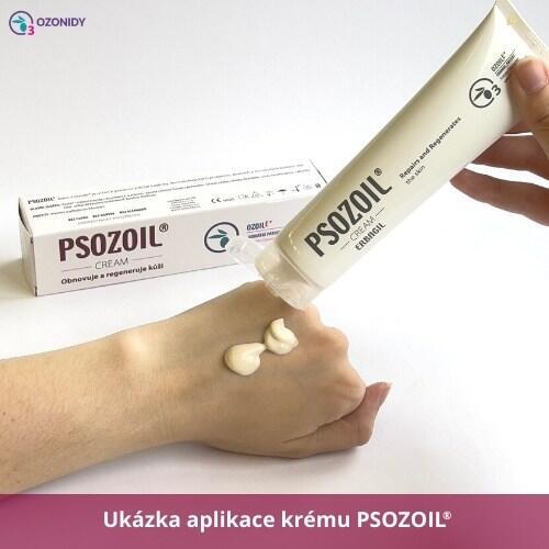 PSOZOIL - Krém na lupénku 100 ml