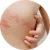 Pásový opar