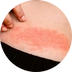 Opruzeniny