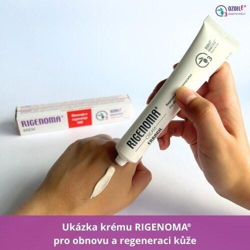 RIGENOMA krém pro obnovu a regeneraci kůže s OZOILE
